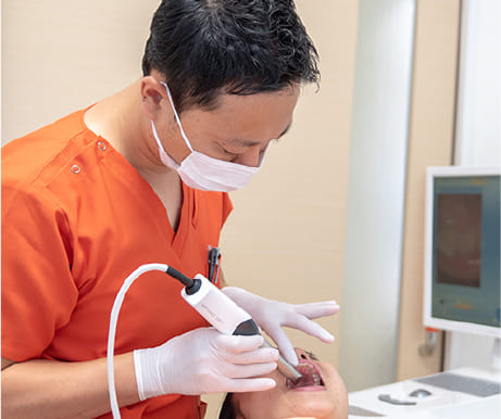 口腔内スキャナ